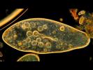 Amazing Microscopic HD Video! Paramecium Feeding!!