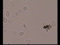 Сперма под темнопольным микроскопом.